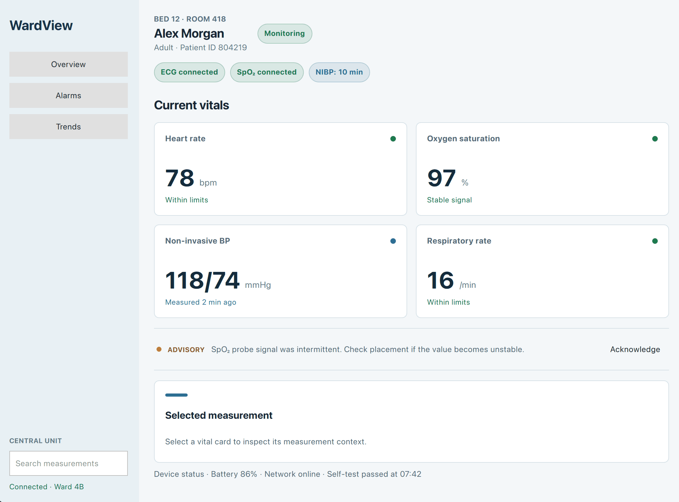 WardView project preview